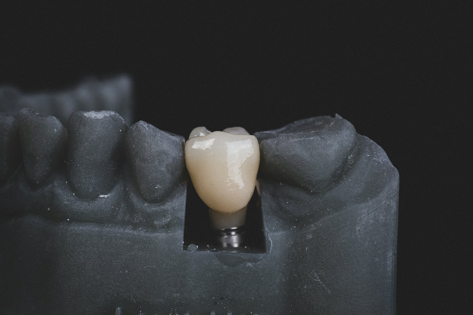 Ceramic crown seated on a working model